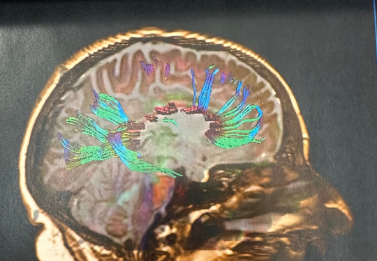 NorthStar Neurology P.C. / NorthStar Hyperbaric