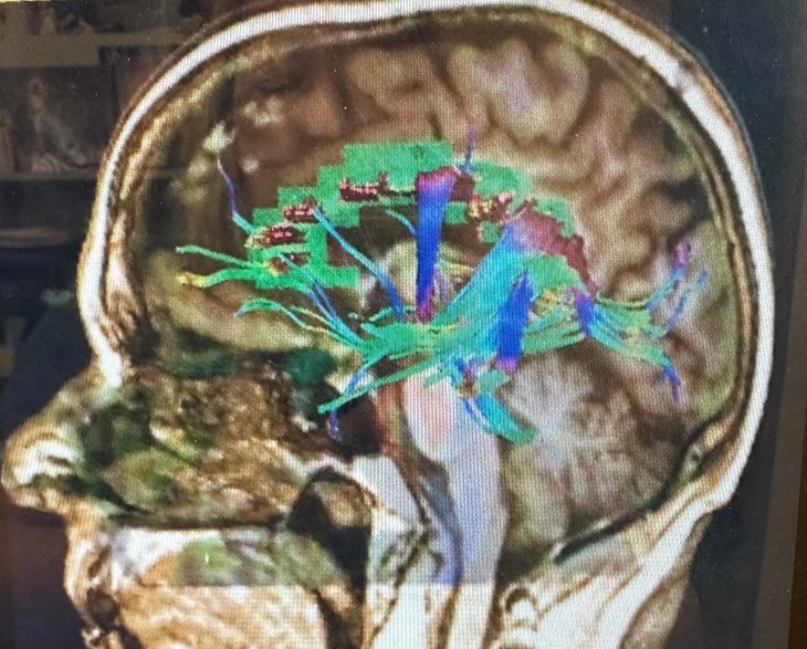 NorthStar Neurology P.C. / NorthStar Hyperbaric