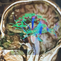 NorthStar Neurology P.C. / NorthStar Hyperbaric 