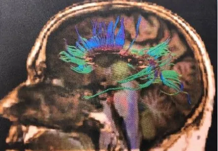 NorthStar Neurology P.C. / NorthStar Hyperbaric