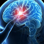 NorthStar Neurology P.C. / NorthStar Hyperbaric 