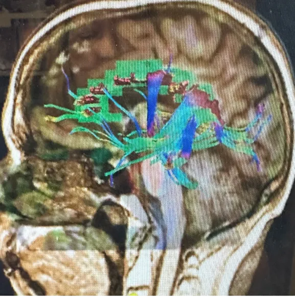 NorthStar Neurology P.C. / NorthStar Hyperbaric 