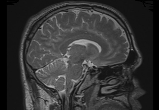 NorthStar Neurology P.C. / NorthStar Hyperbaric 